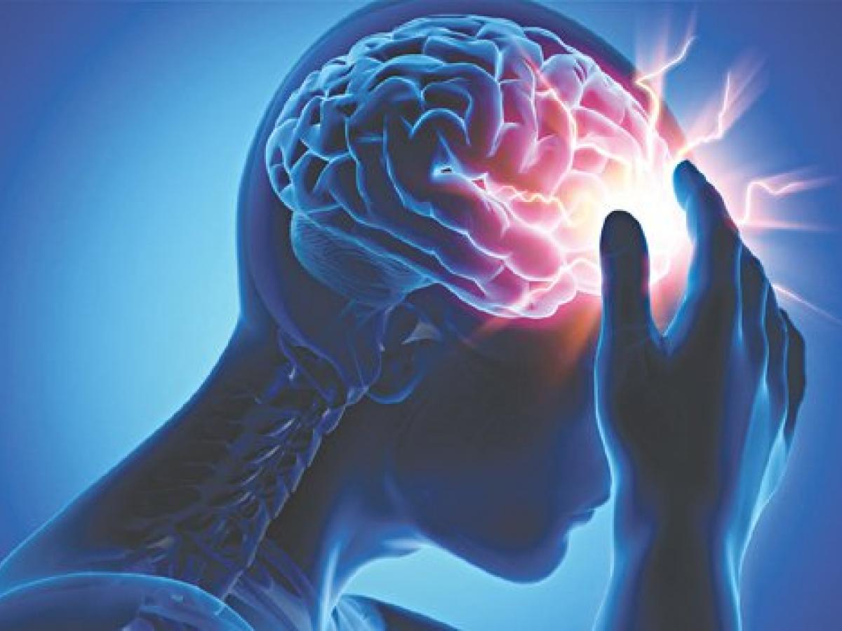 Chia sẻ thông tin về đột quỵ